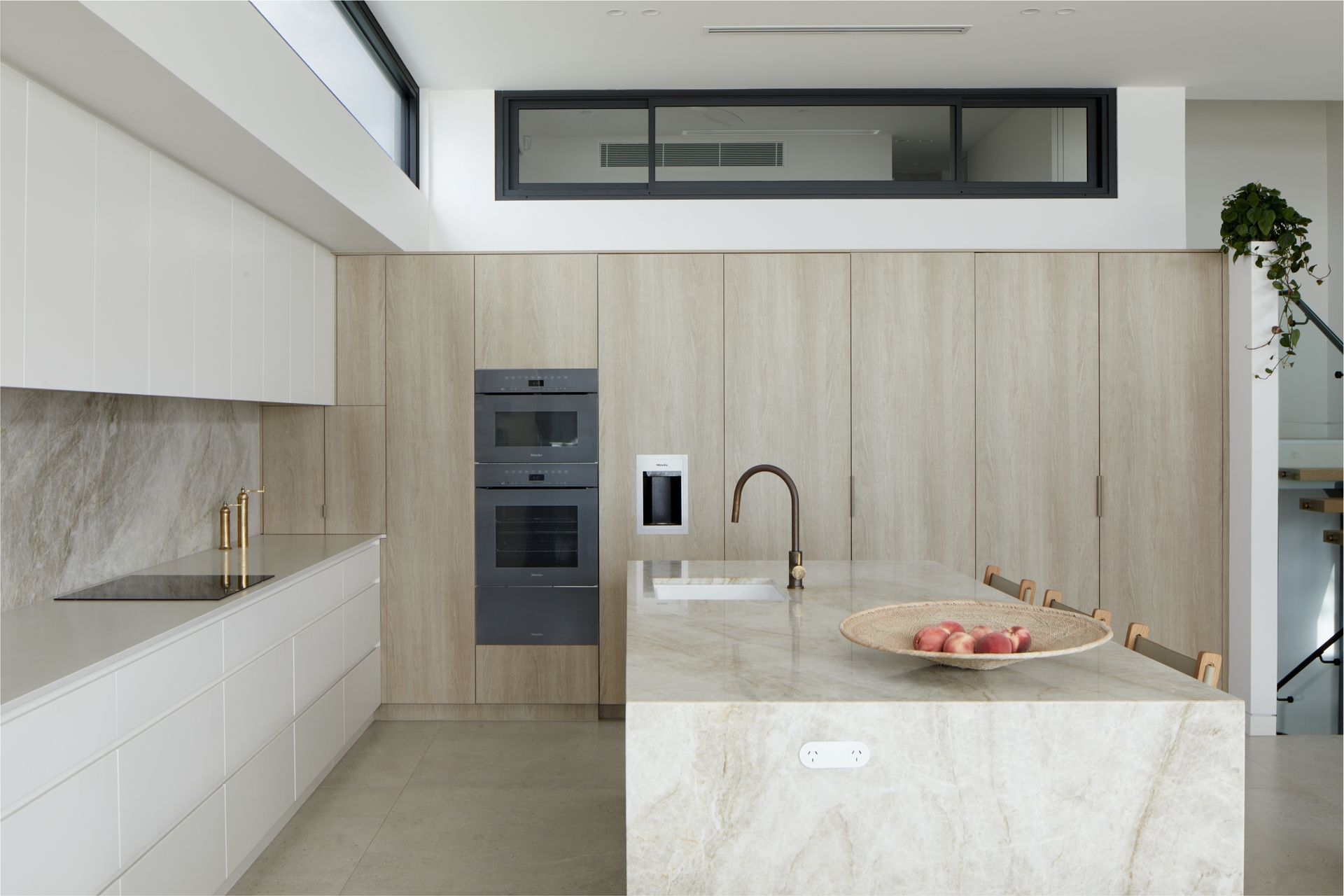 Supporting Image 6 for New Age Veneers